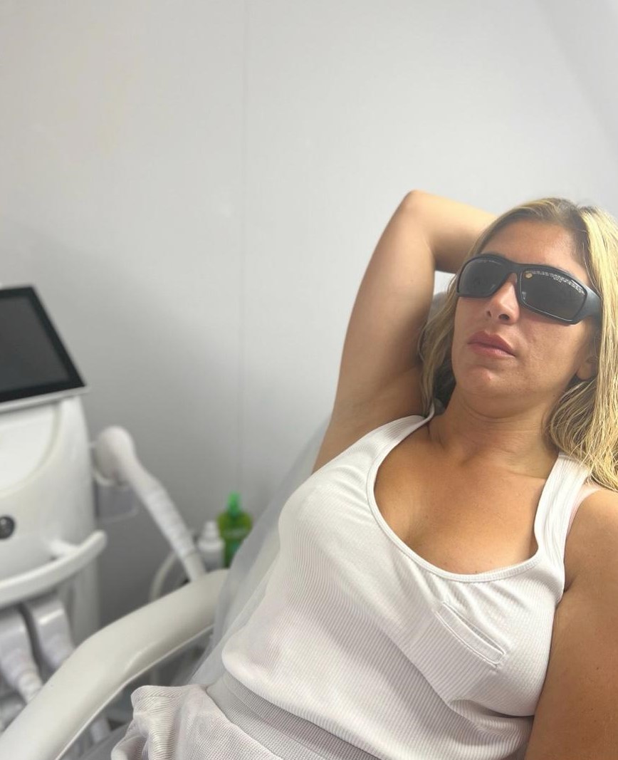 laser hair removal